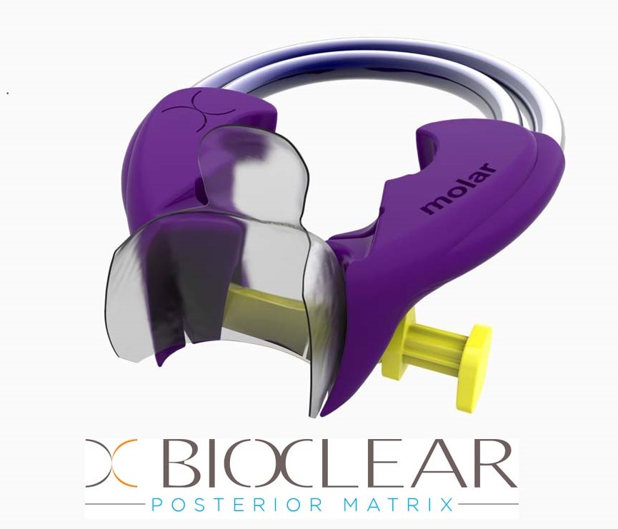 POSTERIOR MATRIX SYSTEM